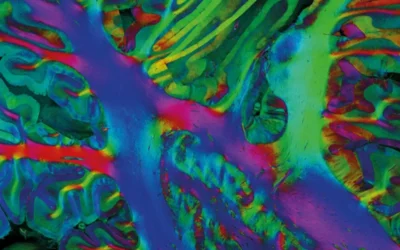 Deadline Extended: EBRAINS Call for Contributions to the European Roadmap in Digital Neuroscience 2026–2036